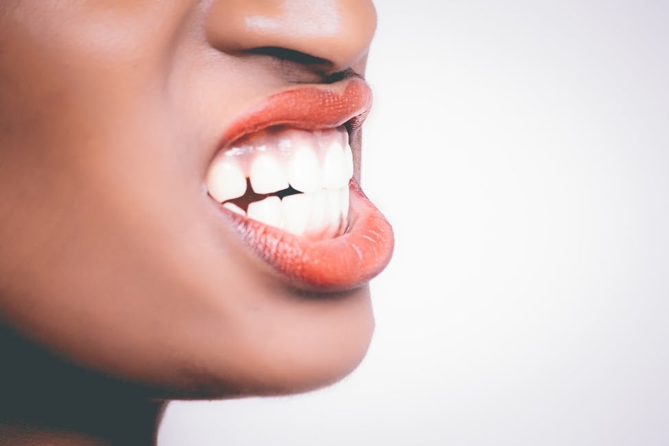 What You Need to Know About Hyperdontia